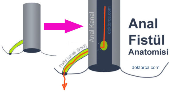 Anal Fistül Anatomisi