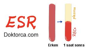 esr-nedir