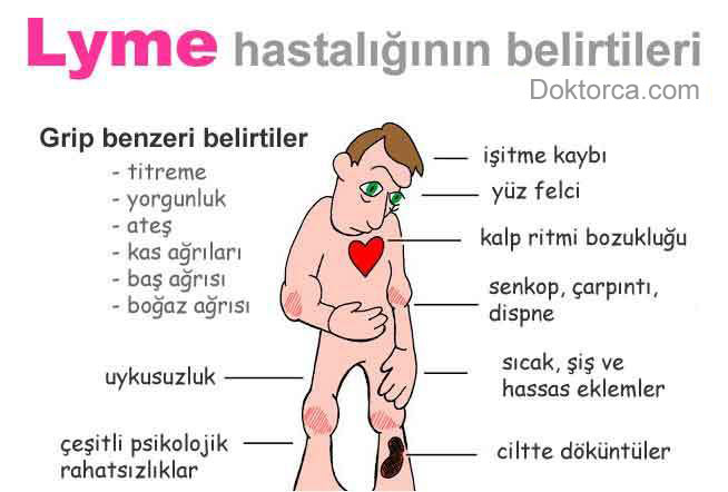 Lyme hastalığının belirtileri