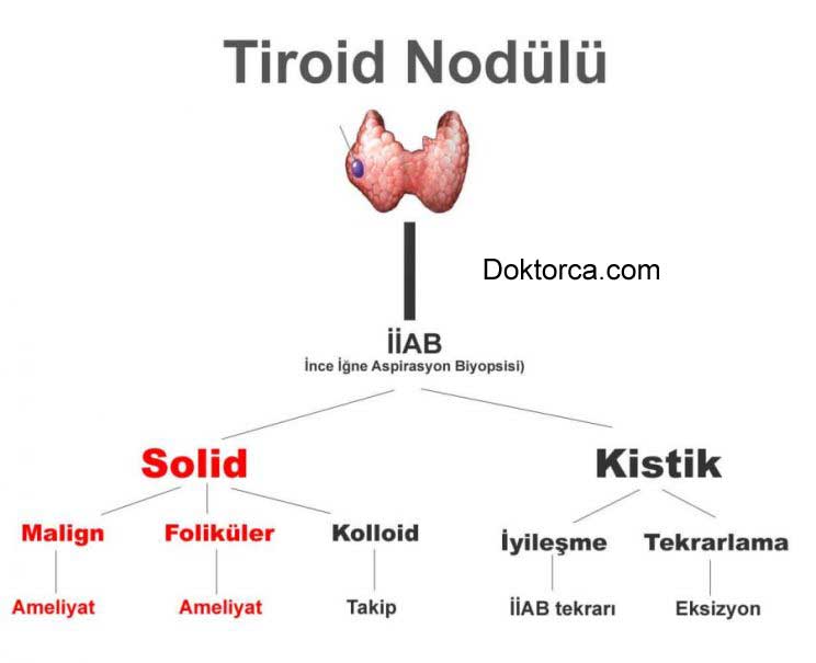 tiroid algoritması
