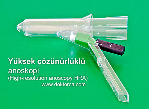 Yüksek çözünürlüklü anoskopi (High-resolution anoscopy HRA)